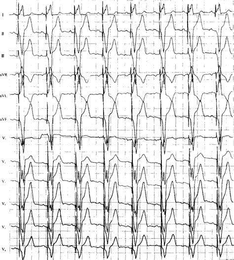 具有心跳/脉搏和心率监测器符号的医学背景图画图标高清摄影大图-千库网