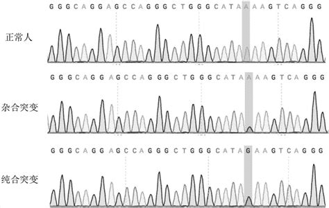 Rett综合征的临床特点及MECP2基因突变分析