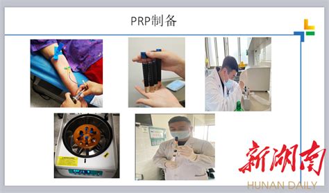 道格骨科PRP治疗中心正式成立！_重庆道格骨科医院