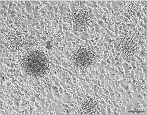 自然杀伤细胞——细胞免疫疗法的下一个“引爆点”！