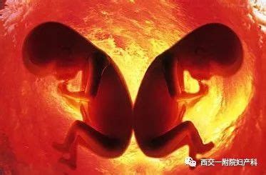 如何生双胞胎 生养好孕育龙凤胎秘诀-百度经验