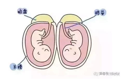 同卵双胞胎和异卵双胞胎的区别_知秀网