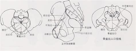 图5-13 胎头入盆示意图-临床解剖学-医学