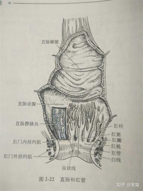直肠前突图片