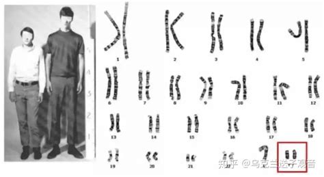 关于人类染色体核型报告解读及相关案例简述 | LRC - 知乎