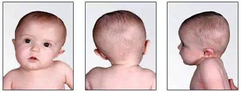 婴儿五个月脖子有点歪（宝宝经常歪脖子危害大）-幼儿百科-魔术铺