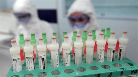 俄罗斯卫生部批准使用中国羟氯喹治疗新冠肺炎 - 2020年4月19日, 俄罗斯卫星通讯社