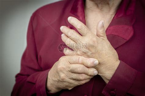 因类风湿关节炎而变形的女人的手疼痛高清图片下载-正版图片502716259-摄图网