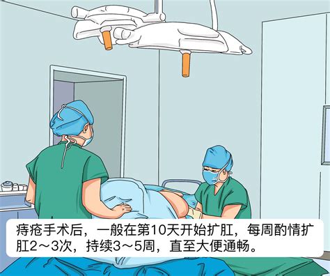 痔疮刚开始的图片