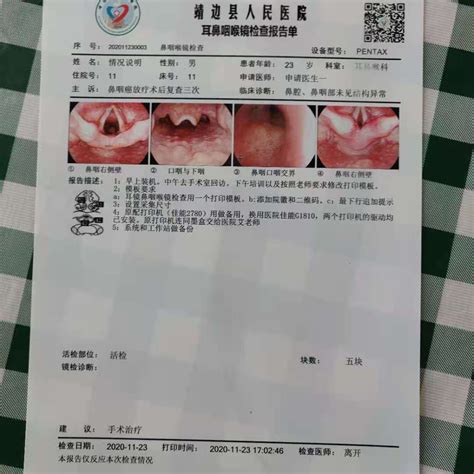 耳鼻喉科医讯 - 最新医讯 - 靖边县人民医院【官网】