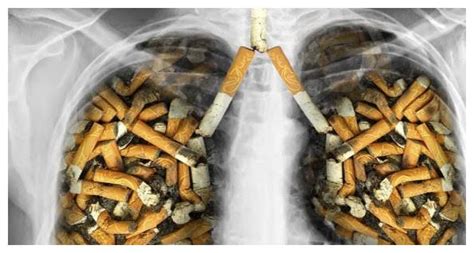 吸烟有害健康 吸烟人的肺对比图片让人触目惊心！_3DM单机