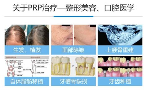 PRP临床应用 - 广州派俪生物科技有限公司