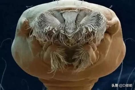 3000倍显微镜下的寄生虫, 你知道它们像什么吗?|微观世界|寄生虫|显微镜_新浪新闻