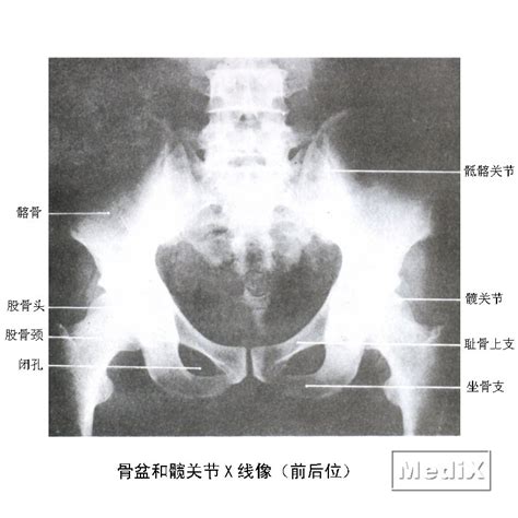 骨盆x线解剖图图片