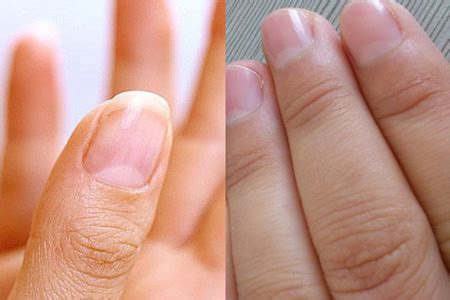 【指甲】【图】指甲上的月牙代表什么 体质都由它表现_伊秀健康|yxlady.com