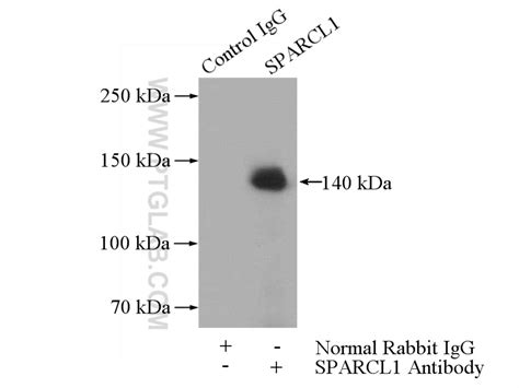 SPARCL1 Antibody 13517-1-AP | Proteintech