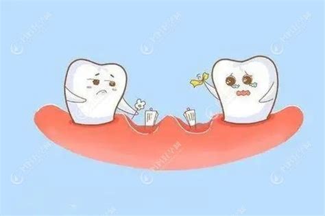 牙齿三度松动标准:超过3mm必须拔掉,不拔仅能保留1-2个月-儿牙-妈妈好孕网