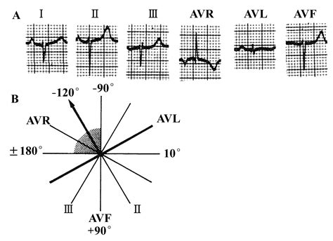 纯干货，系统解读心电图的9个步骤 |心电图学习一日通_心电图_心电图系统学习一日通_医脉通