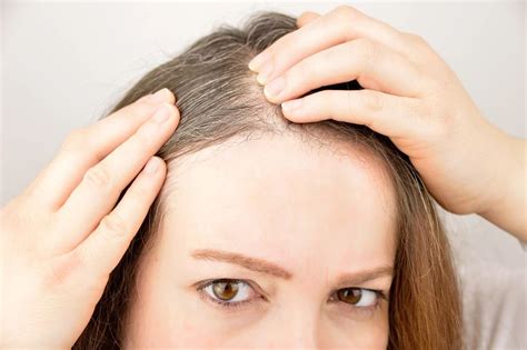 每天头发一抓掉一大把，预防和解决脱发，做好这7件事