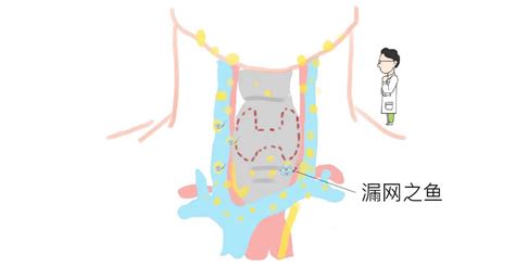 甲状腺癌术后需做碘131治疗吗？-武汉市江汉区科学技术协会