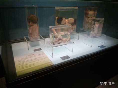 杭州自然博物馆里的人体标本是真的吗？ - 知乎