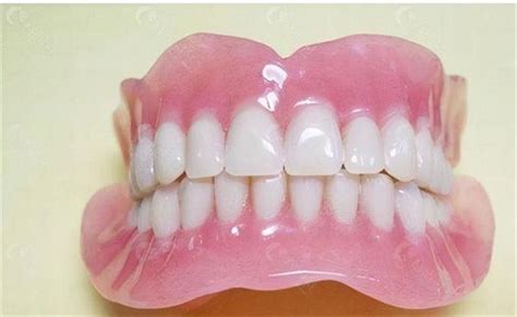 全口杆卡式覆盖义齿修复病例一例-吕昊昕的博客-KQ88口腔博客