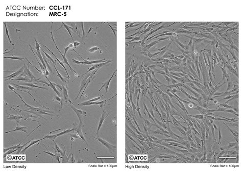MRC-5细胞ATCC CCL-171细胞 MRC5人胚肺细胞株购买价格、培养基、培养条件、细胞图片、特征等基本信息_生物风