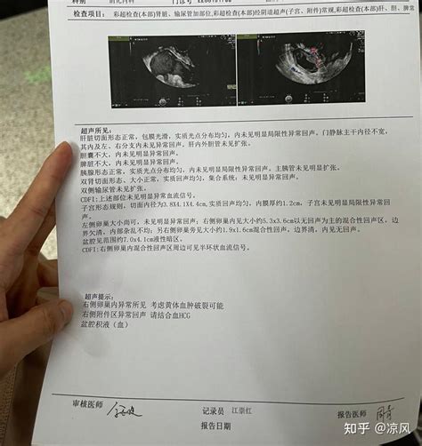 黄体破裂与宫外孕破裂的超声鉴别诊断-MedSci.cn