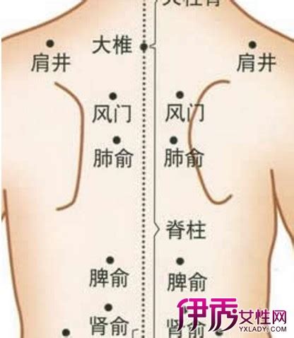 人体背部拔罐图图片
