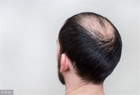 【健康】4种错误的洗头方式让你的头发越掉越多！_图片新闻_汕头市卫生健康局（中医药局）
