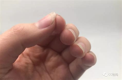手指竖纹预示身体什么，指甲没有月牙代表什么-七乐剧