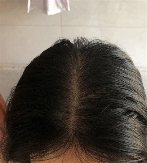 头发又细又软怎么办，造成这种发质的原因是什么，我们该如何解决发质细软问题？ - 知乎