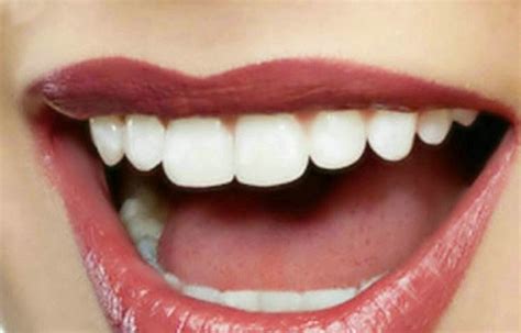 莞大口腔连锁品牌-东莞东城莞大口腔医院-牙齿种植|牙齿矫正|牙齿美白|牙齿修复|种植矫正专科医疗机构