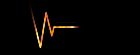 安装心脏起搏器的患者该如何判定死亡？_临床