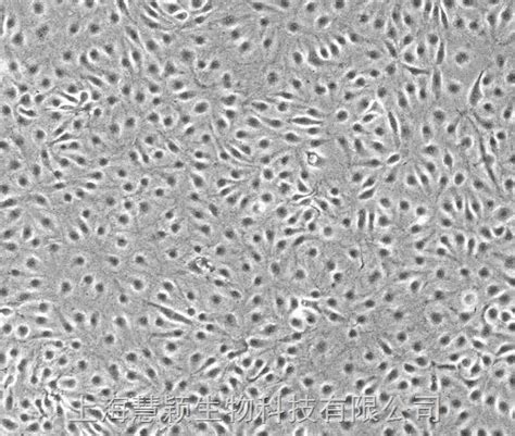 THLE-2细胞ATCC CRL-2706细胞THLE2人肝永生化细胞株购买价格、培养基、培养条件、细胞图片、特征等基本信息_生物风