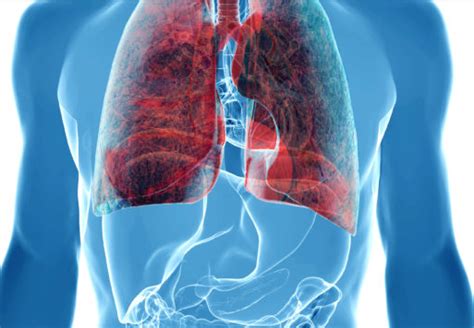 肺癌晚期的具体表现是什么？肺癌晚期症状的具体表现-肺癌症状-复禾健康