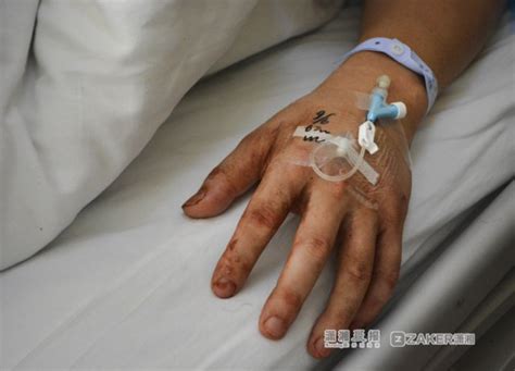 疑因看了对方一眼 男子被5名陌生人围殴打伤进医院_湖南频道_凤凰网