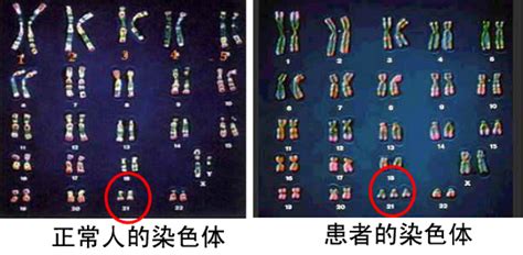 图5表示某植物正常体细胞的染色体组成.下列各选项中.可能是 该植物基因型的是( ) A.ABCd B.Aaaa C.AaBbCcDd D ...