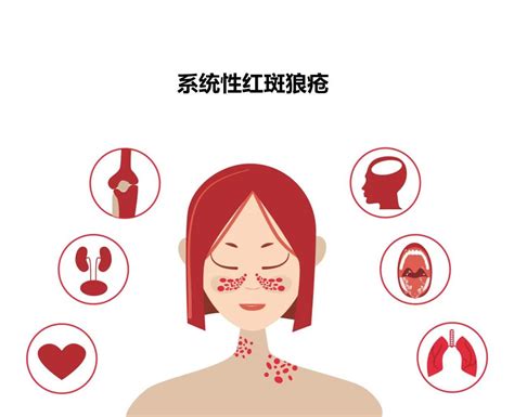 风湿免疫科-陕西省人民医院