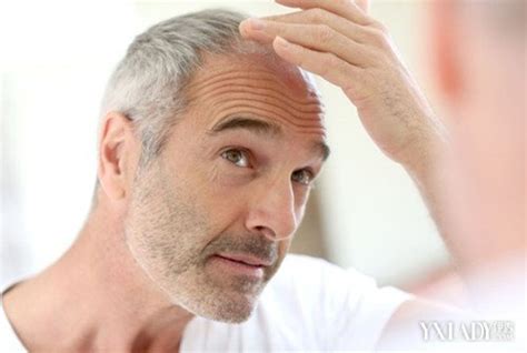 【图】如何治疗头发早白的症状 介绍6种经典食疗方助你防治白发(3)_如何治疗头发早白_伊秀美容网|yxlady.com