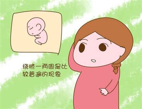 孕晚期如何降低胎儿脐绕颈的概率？ - 知乎