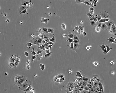 培养RAW264.7细胞常见问题及原因分析-苏州千舍生物科技有限公司