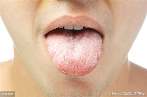 舌尖发麻是怎么回事怎么办（舌头发麻怎么回事？出现频繁，背后的三个原因要重视） | 说明书网