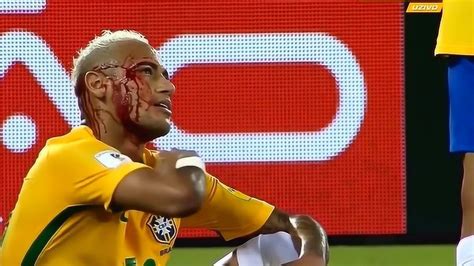 梅西C罗和内马尔足球场上受伤流血，梅西低头吐血_腾讯视频