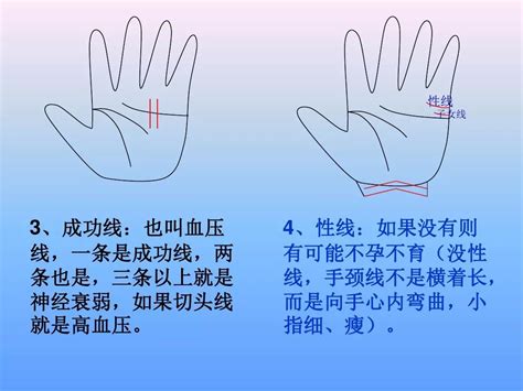 手诊图解看疾病图片