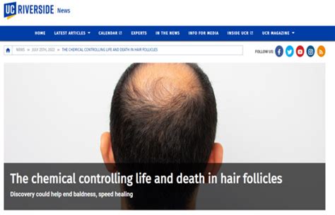 脱发有救了：UCR研究员发现控制毛囊细胞蛋白质 - 国际日报