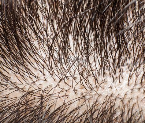 为什么人类的头发会一直长，而灵长类或其他动物却不会。？ - 知乎
