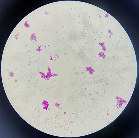 细菌的简单染色和革兰氏染色及其注意事项-环凯微生物官网
