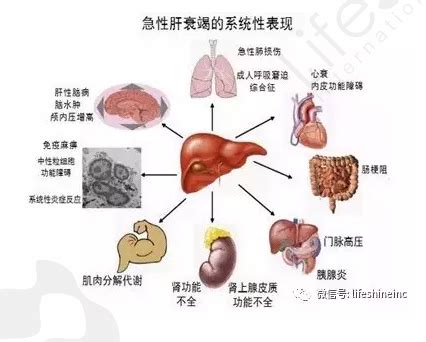 肝功能异常有哪些症状表现_肝病保健_肝病_99健康网