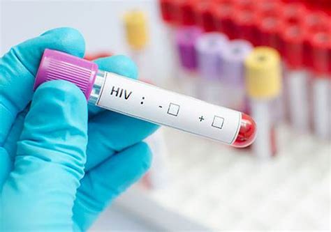 VCT检测是什么 艾滋病最佳检查时间-健康经验本